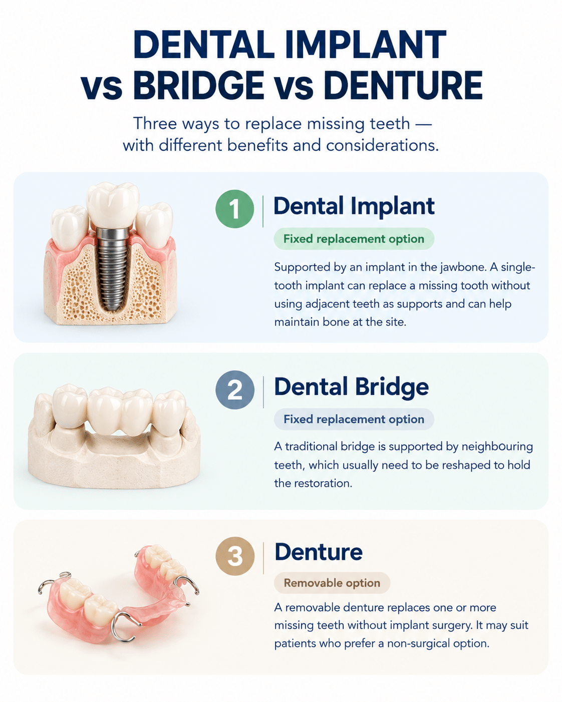 Dental Implant vs Bridge vs Denture